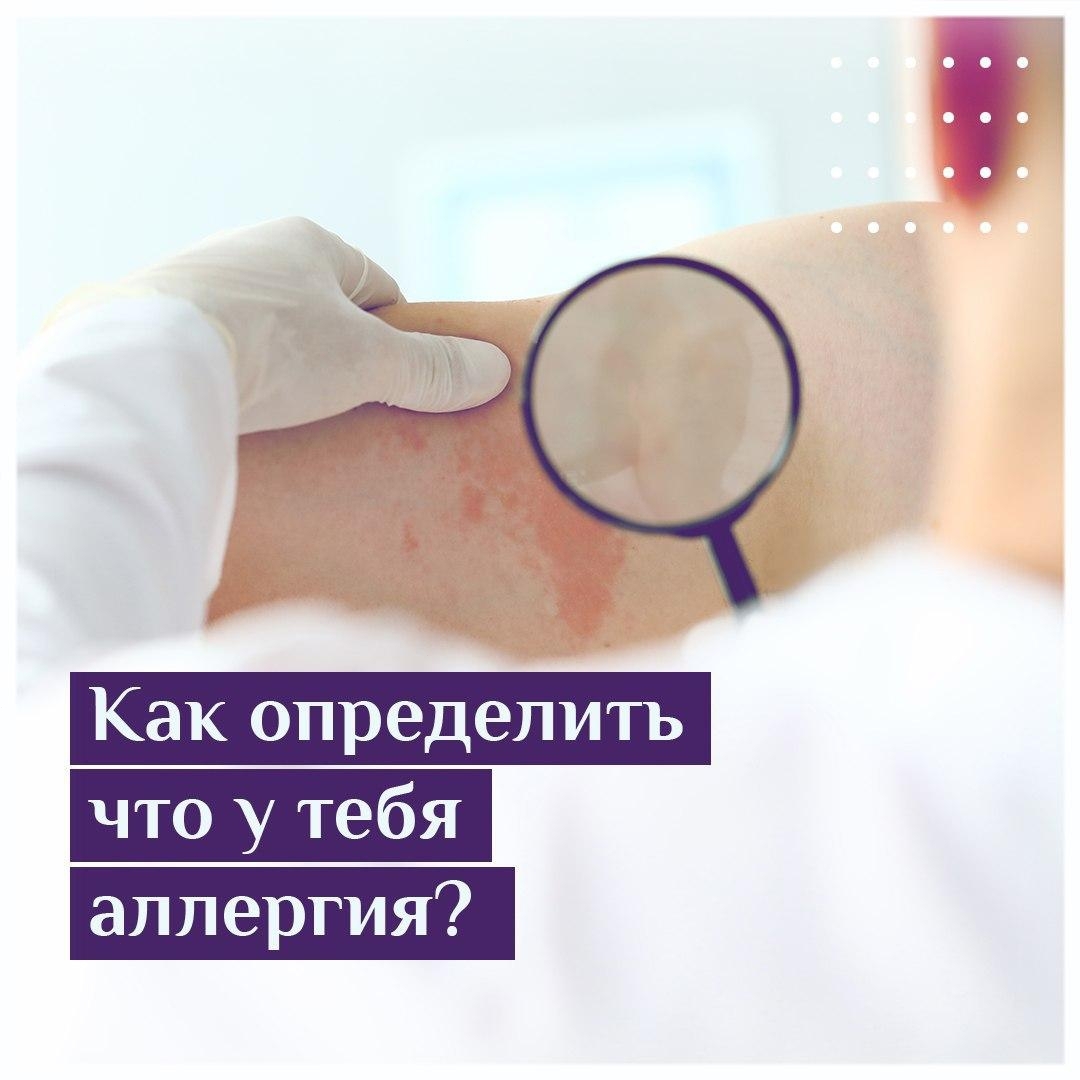 Аллергия на теле под лупой